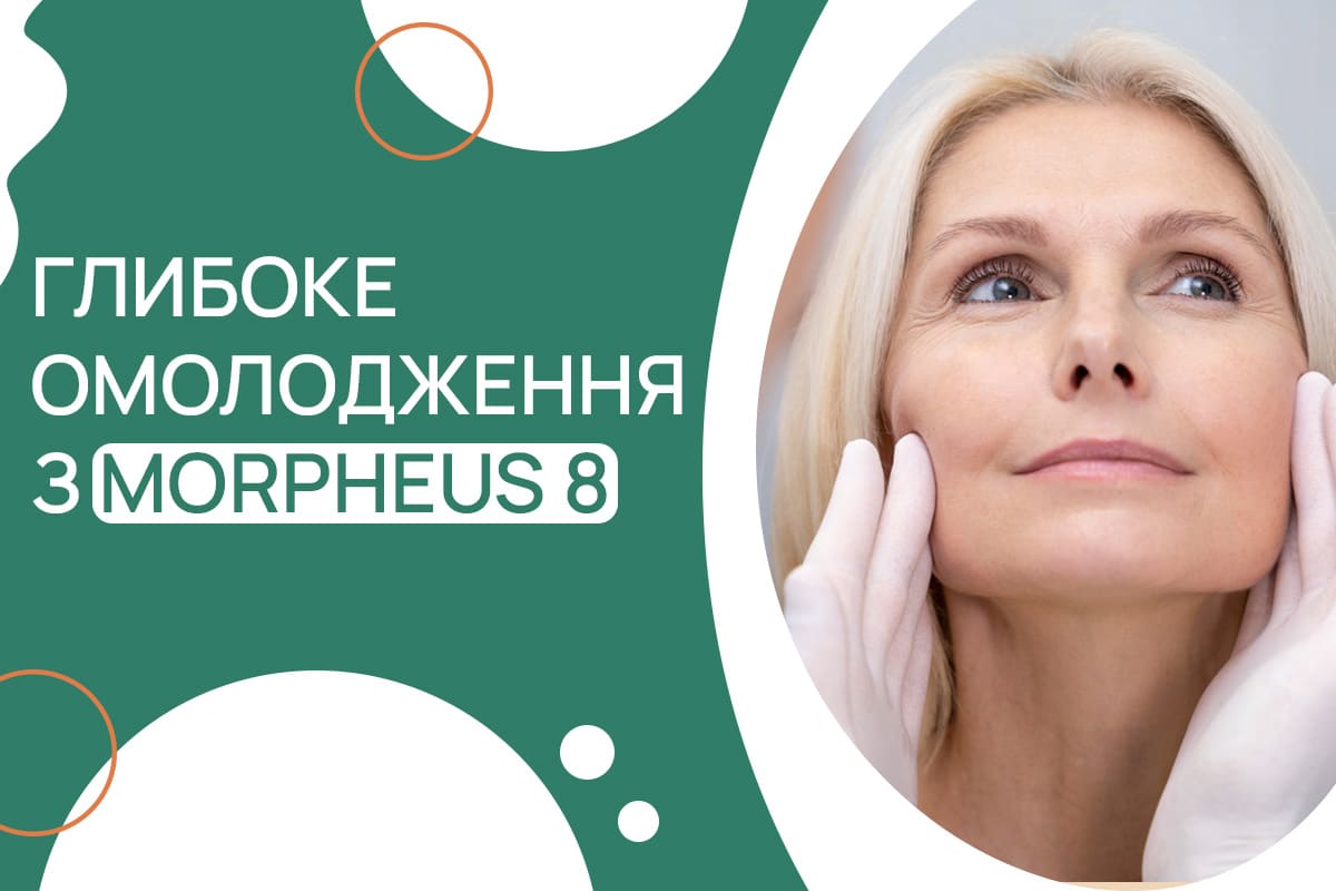 Вартість послуг МЦ ADONIS Суперціни на Morpheus 8