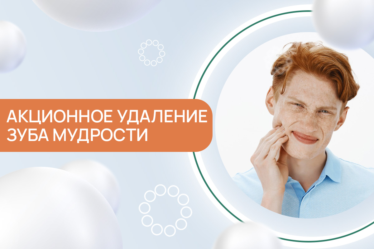 Удаление зуба мудрости от 3 050 грн – ADONIS | Киев