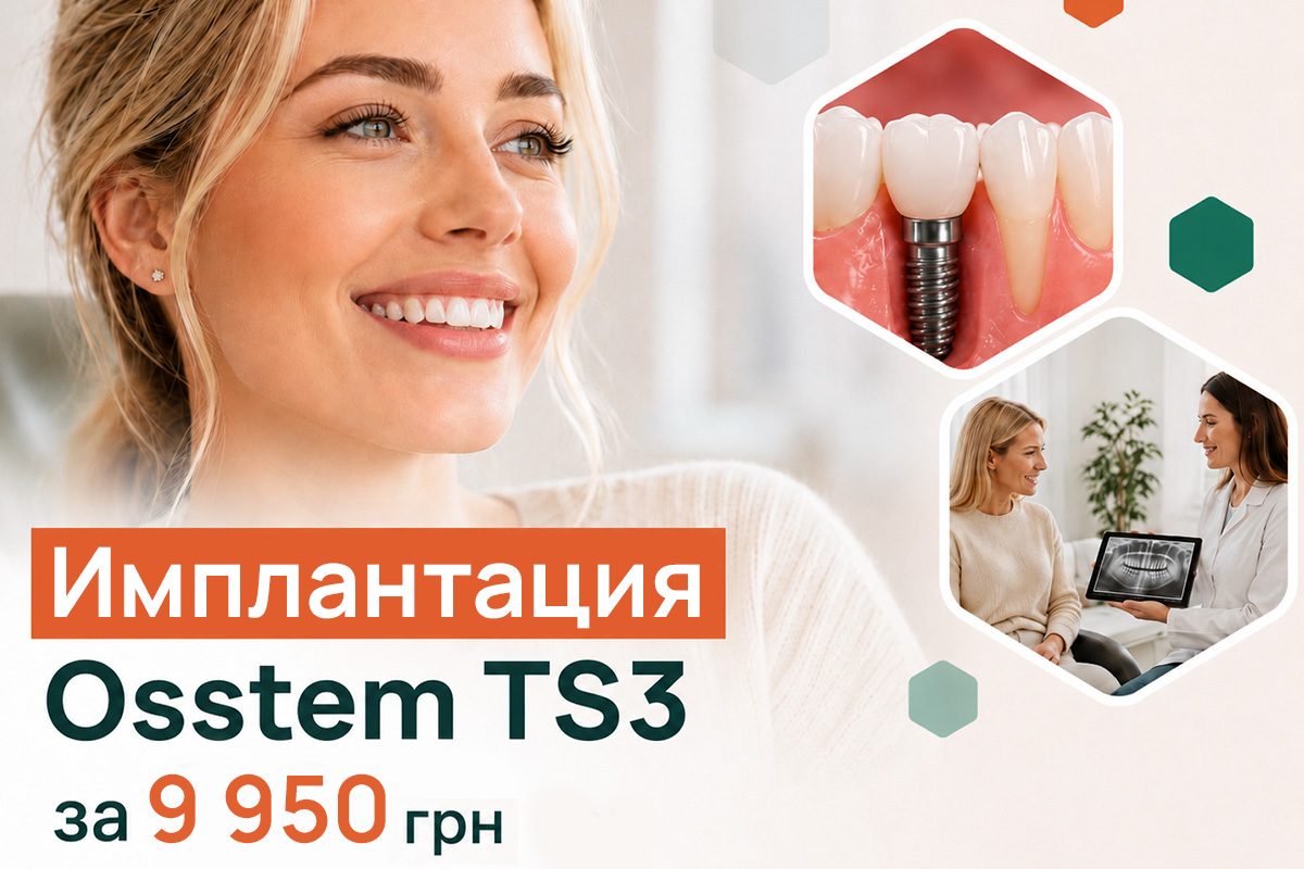 Качественная имплантация без переплат