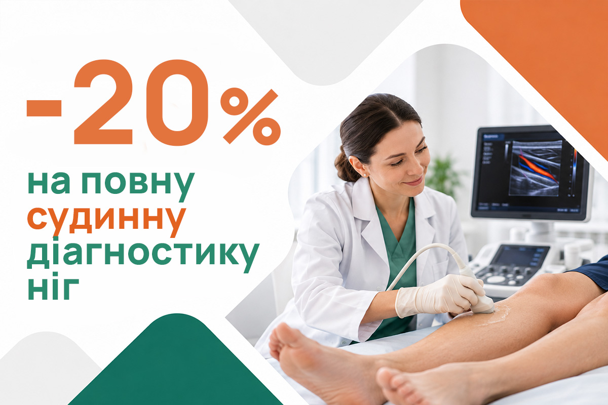 Легкі ноги — огляд та УЗД вен зі знижкою 20%